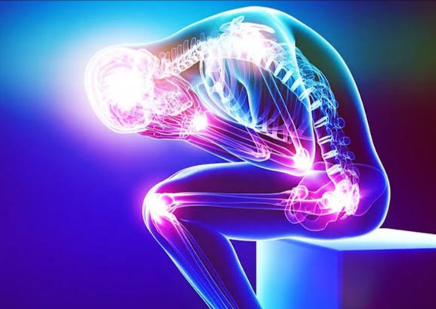 Illustration of nerve pain throughout the body